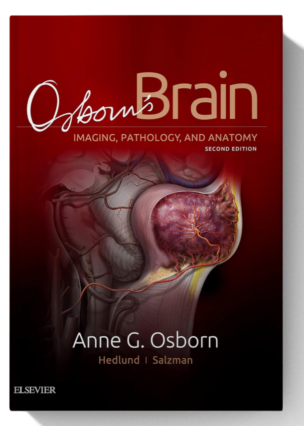 Osborn's Brain: Osborn's Brain E-Book 2nd Edition