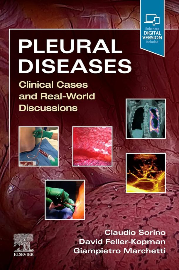 Pleural Diseases Clinical Cases and Real-World Discussions 1st Edition