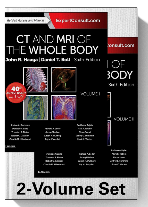 CT and MRI of the Whole Body, 2-Volume Set 6th Edition