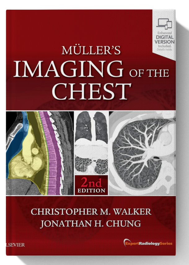 Muller's Imaging of the Chest: Expert Radiology Series 2nd Edition