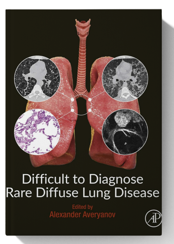 Difficult to Diagnose Rare Diffuse Lung Disease 1st Edition