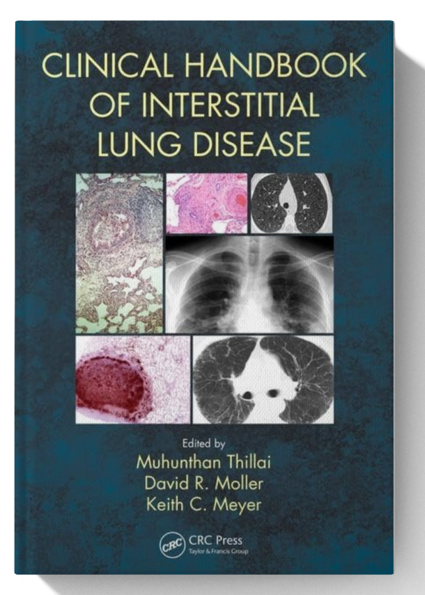 Clinical Handbook of Interstitial Lung Disease 1st Edition