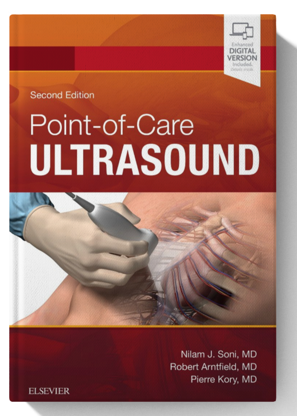 Point of Care Ultrasound 2nd Edition