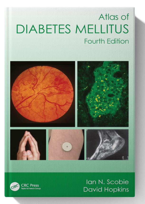 Atlas of Diabetes Mellitus 4th Edition