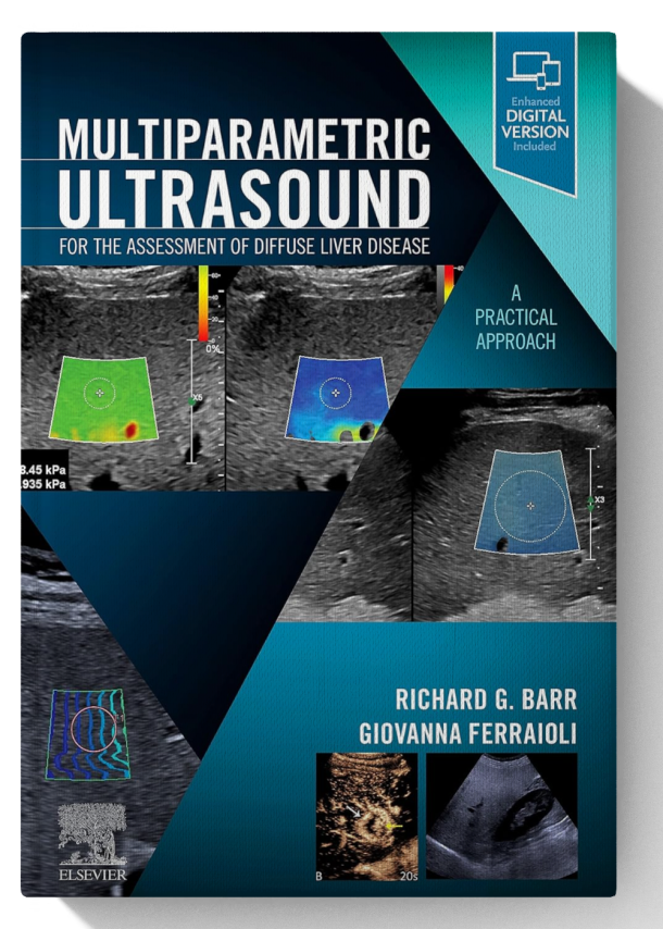 Multiparametric Ultrasound for the Assessment of Diffuse Liver Disease: A Practical Approach 1st Edition