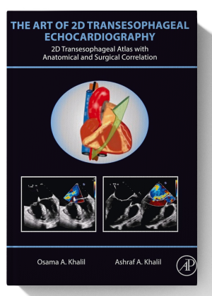 The Art of 2D Transesophageal Echocardiography: 2D Transesophageal Atlas with Anatomical and Surgical Correlation
