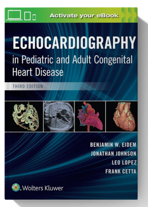 Echocardiography in Pediatric and Adult Congenital Heart Disease 3rd Edition