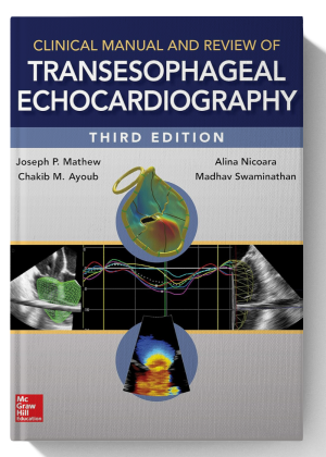 Clinical Manual and Review of Transesophageal Echocardiography, 3/e 3rd Edition